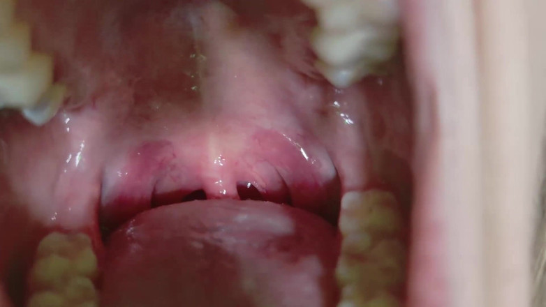 Victoria Lotus: Savory Flossing Uvula and Mouth Tour Gum Stretching Sense