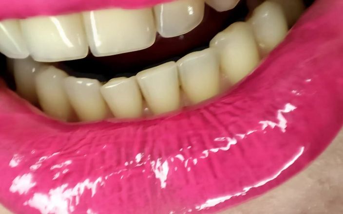 Princess18_: Permanent Retainers Mouth Tour