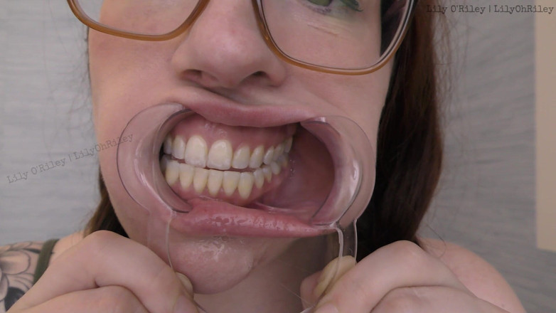 Lily O'Riley: Glasses and Gape: 11-min Dental Speculum-stretched Drool Session