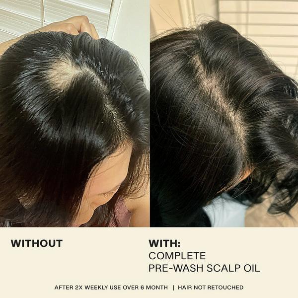 JVN Complete Pre-Wash Scalp Oil #7