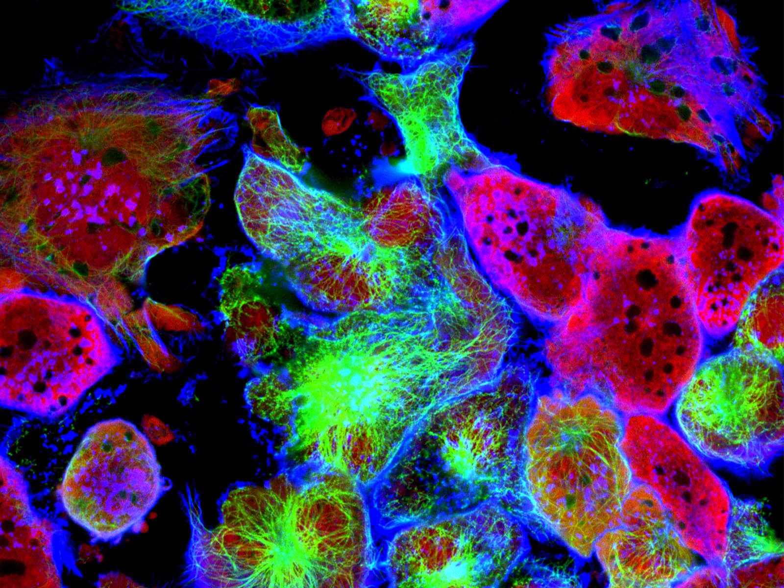 A picture of cancer cells